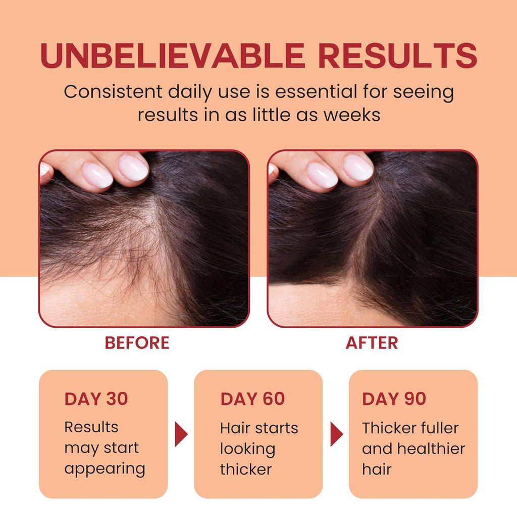 Root Revival Hair Growth System