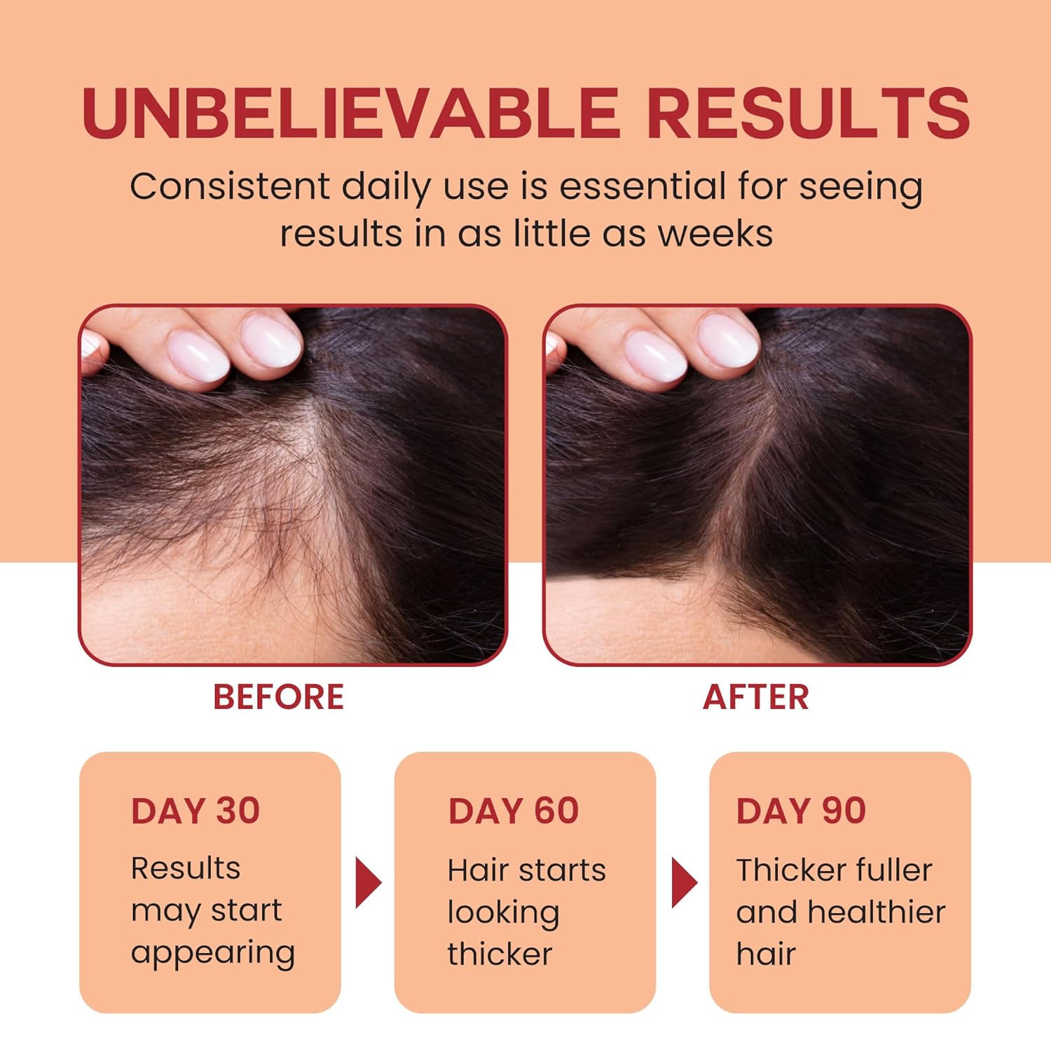 Root Revival Hair Growth System
